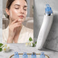 Aesthetic Pore Refining System – Electric Blackhead Remover with 4 Suction Heads